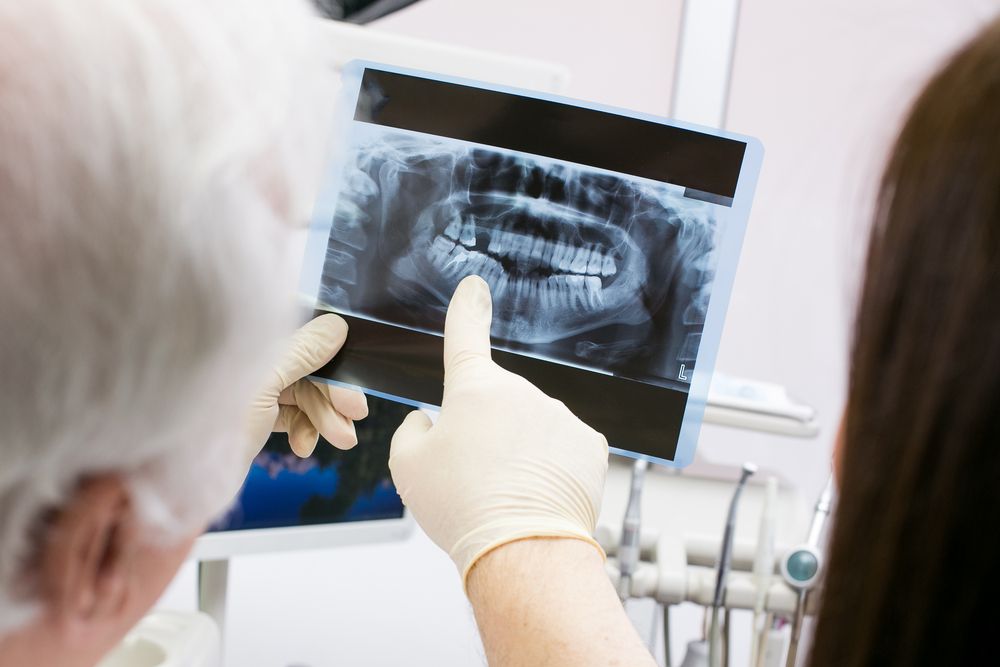 Dental-Xray.jpg.optimal