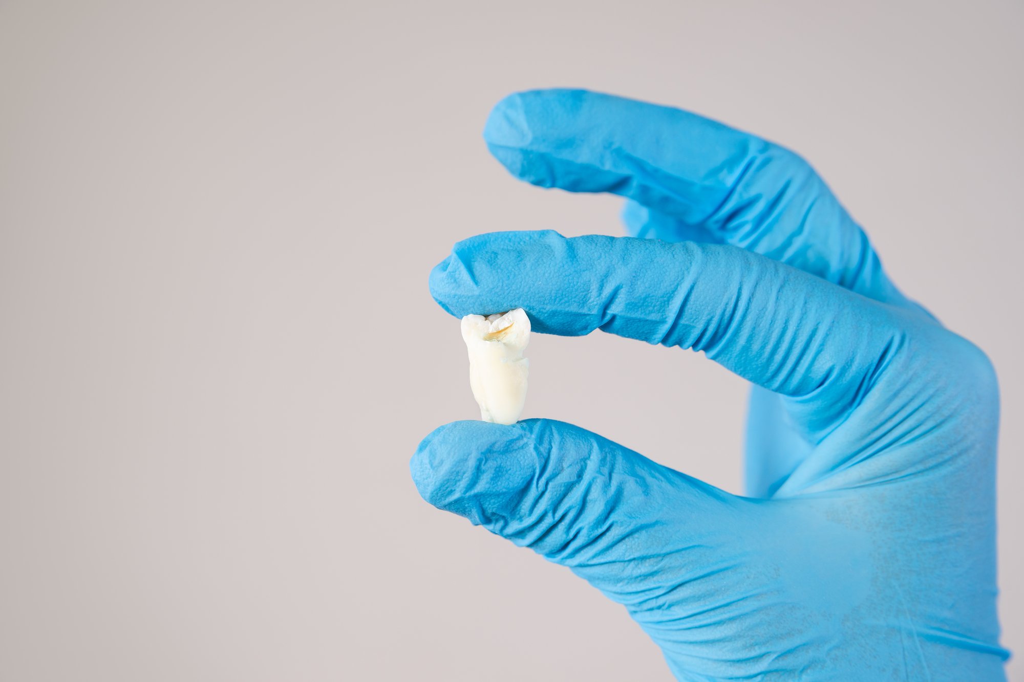 Depositphotos_389619690_L