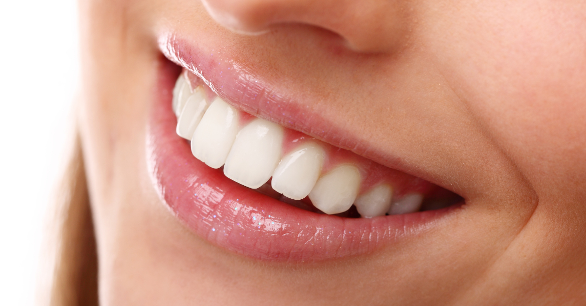 healthy teeth and gums smile