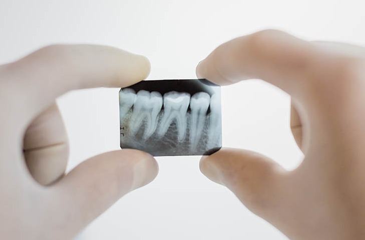 dental-x-ray-utltb7f